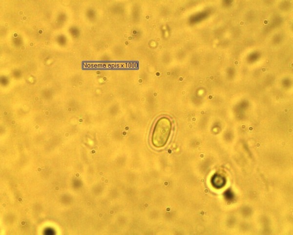 Nosema